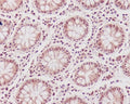 IHC staining of FFPE human colon tissue with CDK1 antibody. HIER: boil tissue sections in pH6, 10mM citrate buffer, for 10-20 min and allow to cool before testing.