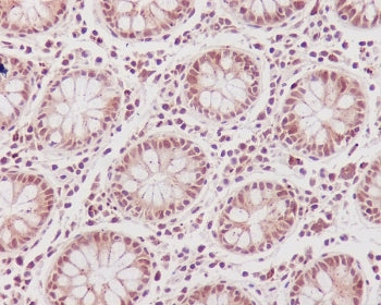 IHC staining of FFPE human colon tissue with CDK1 antibody. HIER: boil tissue sections in pH6, 10mM citrate buffer, for 10-20 min and allow to cool before testing.