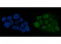 Immunofluorescent staining of FFPE human A431 cells with ATR antibody (green) and DAPI nuclear stain (blue). HIER: steam section in pH6 citrate buffer for 20 min.