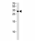 ASCL1 antibody western blot analysis in NCI-H460 lysate. Observed molecular weight ~34 kDa.