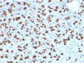 IHC staining of FFPE human pancreas with BARX1 antibody (clone BARX1/2760). HIER: boil tissue sections in pH 9 10mM Tris with 1mM EDTA for 20 min and allow to cool before testing.