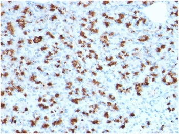 IHC staining of FFPE human pancreas with BARX1 antibody (clone BARX1/2760). HIER: boil tissue sections in pH 9 10mM Tris with 1mM EDTA for 20 min and allow to cool before testing.