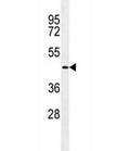 TMPRSS11E2 antibody western blot analysis in NCI-H292 lysate.