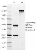 SDS-PAGE analysis of purified, BSA-free H. pylori antibody (clone HP/1335) as confirmation of integrity and purity.