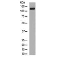 Western blot testing of human skin lysate with Collagen XVII antibody at 0.5ug/ml. Expected molecular weight ~120 kDa and ~180 kDa.