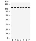 Western blot testing of 1) rat lung, 2) mouse lung, 3) HeLa, 4) MM231, 5) COLO320, 6) A549 and 7) mouse NIH3T3 lysate with SAP97 antibody. Predicted molecular weight: ~103 kDa, rountinely observed at ~140 kDa (Ref 1).