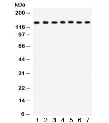 Western blot testing of 1) rat lung, 2) mouse lung, 3) HeLa, 4) MM231, 5) COLO320, 6) A549 and 7) mouse NIH3T3 lysate with SAP97 antibody. Predicted molecular weight: ~103 kDa, rountinely observed at ~140 kDa (Ref 1).