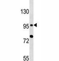TLR6 antibody western blot analysis in MCF-7 lysate