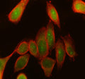 Immunofluorescent staining of RPS6KA3 using anti-RPS6KA3 antibody (green) and anti-Beta Tubulin antibody (red). RPS6KA3 was detected in immunocytochemical section of SiHa cell. Enzyme antigen retrieval was performed using IHC enzyme antigen retrieval reagent for 15 mins. The cells were blocked with 10% goat serum. And then incubated with 5 ug/ml rabbit anti-RPS6KA3 antibody and mouse anti-Beta Tubulin antibody overnight at 4oC.