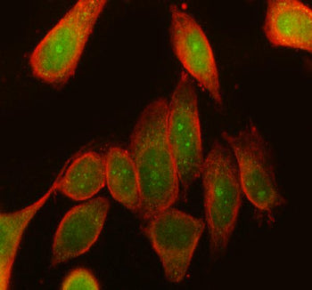 Immunofluorescent staining of RPS6KA3 using anti-RPS6KA3 antibody (green) and anti-Beta Tubulin antibody (red). RPS6KA3 was detected in immunocytochemical section of SiHa cell. Enzyme antigen retrieval was performed using IHC enzyme antigen retrieval reagent for 15 mins. The cells were blocked with 10% goat serum. And then incubated with 5 ug/ml rabbit anti-RPS6KA3 antibody and mouse anti-Beta Tubulin antibody overnight at 4oC.