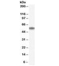 Western blot testing of human bone marrow lysate with NAC1 antibody at 0.5ug/ml. Predicted molecular weight: ~57 kDa, commonly observed at 57-70 kDa.