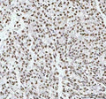 IHC staining of FFPE human testicular germ cell tumor tissue with RNA-binding motif protein 3 antibody. HIER: boil tissue sections in pH8 EDTA for 20 min and allow to cool before testing.