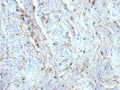 IHC staining of FFPE human uterus tissue with recombinant CD34 antibody (clone rICO-115). HIER: boil tissue sections in pH 9 10mM Tris with 1mM EDTA for 20 min and allow to cool before testing.