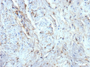 IHC staining of FFPE human uterus tissue with recombinant CD34 antibody (clone rICO-115). HIER: boil tissue sections in pH 9 10mM Tris with 1mM EDTA for 20 min and allow to cool before testing.
