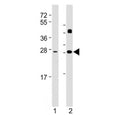 Western blot testing of DKK2 antibody at 1:2000: Lane 1) human brain and 2) mouse heart lysate. Expected molecular weight: 28-35 kDa.
