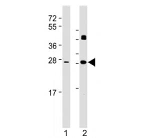 Western blot testing of DKK2 antibody at 1:2000: Lane 1) human brain and 2) mouse heart lysate. Expected molecular weight: 28-35 kDa.
