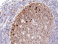 IHC testing of FFPE human tonsil tissue with recombinant Ki67 antibody. HIER: boil tissue sections in pH6, 10mM citrate buffer, for 10-20 min and allow to cool before testing.