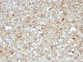 IHC staining of FFPE human brain tissue with S100B antibody (clone S100B/4143) at 2ug/ml. HIER: boil tissue sections in pH 9 10mM Tris with 1mM EDTA for 20 min and allow to cool before testing.