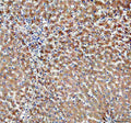 Immunohistochemical staining of PDZK1 using anti-PDZK1 antibody. PDZK1 was detected in a paraffin-embedded section of human liver tissue. Heat mediated antigen retrieval was performed in EDTA buffer (pH 8.0, epitope retrieval solution). The tissue section was blocked with 10% goat serum. The tissue section was then incubated with 2 ug/ml rabbit anti-PDZK1 antibody overnight at 4oC. Peroxidase Conjugated Goat Anti-rabbit IgG was used as secondary antibody and incubated for 30 min at 37oC.