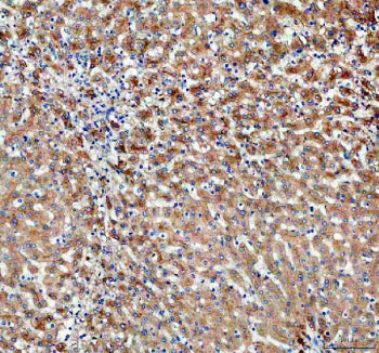 Immunohistochemical staining of PDZK1 using anti-PDZK1 antibody. PDZK1 was detected in a paraffin-embedded section of human liver tissue. Heat mediated antigen retrieval was performed in EDTA buffer (pH 8.0, epitope retrieval solution). The tissue section was blocked with 10% goat serum. The tissue section was then incubated with 2 ug/ml rabbit anti-PDZK1 antibody overnight at 4oC. Peroxidase Conjugated Goat Anti-rabbit IgG was used as secondary antibody and incubated for 30 min at 37oC.