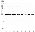 Western blot testing of 1) human placenta, 2) human PC-3, 3) human K562, 4) human HeLa, 5) rat lung, 6) rat liver, 7) mouse lung and 8) mouse liver lysate with Peroxiredoxin 6 antibody. Expected molecular weight: ~25 kDa.