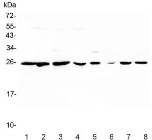 Western blot testing of 1) human placenta, 2) human PC-3, 3) human K562, 4) human HeLa, 5) rat lung, 6) rat liver, 7) mouse lung and 8) mouse liver lysate with Peroxiredoxin 6 antibody. Expected molecular weight: ~25 kDa.