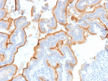 IHC staining of FFPE human small intestine tissue with MUC13 antibody (clone MUC13/13112). HIER: boil tissue sections in pH 9 10mM Tris with 1mM EDTA for 20 min and allow to cool before testing.