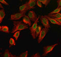 Immunofluorescent staining of SPO11 using anti-SPO11 antibody (green) and anti-Beta Tubulin antibody (red). SPO11 was detected in an immunocytochemical section of Hela cells. Enzyme antigen retrieval was performed using IHC enzyme antigen retrieval reagent for 15 mins. The cells were blocked with 10% goat serum. And then incubated with 5 ug/ml rabbit anti-SPO11 antibody and mouse anti-Beta Tubulin antibody overnight at 4oC.