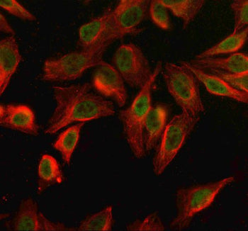 Immunofluorescent staining of SPO11 using anti-SPO11 antibody (green) and anti-Beta Tubulin antibody (red). SPO11 was detected in an immunocytochemical section of Hela cells. Enzyme antigen retrieval was performed using IHC enzyme antigen retrieval reagent for 15 mins. The cells were blocked with 10% goat serum. And then incubated with 5 ug/ml rabbit anti-SPO11 antibody and mouse anti-Beta Tubulin antibody overnight at 4oC.