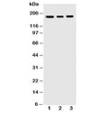 Western blot testing of VEGFR antibody and human cell lysates: 1) MCF-7; 2) SGC; 3) MM231. Predicted molecular weight ~150 kDa but may be observed at higher molecular weights due to glycosylation.
