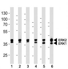 ERK1/2 antibody western blot analysis in (1) 293, (2) MCF-7, (3) Jurkat, (4) mouse NIH3T3, (5) rat C6 cell line and (6) mouse heart lysate. ERK1 ~42 kDa, ERK2 ~43 kDa