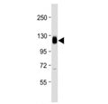 Western blot testing of Thrombomodulin antibody at 1:2000 + human THP1 cell lysate. Expected molecular weight ~60/100 kDa (unmodified/glycosylated).