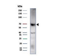 Western blot testing of human HDLM-2 cell lysate with Perforin-1 antibody (clone rPRF1/8058). Predicted molecular weight ~61 kDa.