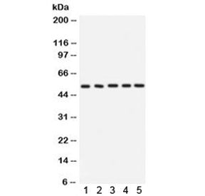 Western blot testing of 1) rat testis, 2) rat pancreas, 3) rat skeletal muscle, 4) mouse kidney and 5) human MCF7 lysate with ARSA antibody. Expected molecular weight: 53-63 kDa.
