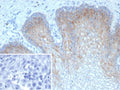 IHC staining of FFPE human esophagus tissue with recombinant TRIM29 antibody (clone TRIM29/9256R). Inset: PBS used in place of primary Ab (secondary Ab negative control). HIER: boil tissue sections in pH 9 10mM Tris with 1mM EDTA for 20 min and allow to cool before testing.