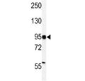Western blot analysis of HIF-1 alpha antibody and MDA-MB231 lysate. Routinely observed molecular weight: 100~120 kDa.