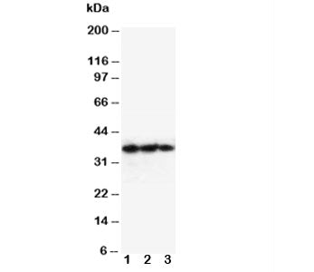 Western blot testing of EPO antibody and Lane 1: Recombinant human protein 10ng; 2: 5ng; 3: 2.5ng. Predicted molecular weight: 18-34 kDa depending on glycosylation level.