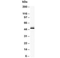 Western blot testing of NSE antibody and rat brain tissue lysate. Predicted molecular weight: ~47 kDa.