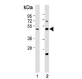 Western blot testing of 1) human kidney and 2) mouse kidney tissue lysate with Galactosylceramide sulfotransferase antibody. Predicted molecular weight ~49 kDa.
