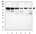 Western blot testing of 1) human HEL, 2) human A549, 3) rat lung, 4) rat heart, 5) mouse lung and 6) mouse heart tissue lysate with STAT3 antibody. Expected molecular weight: ~92 kDa (alpha) and ~83 kDa (beta).