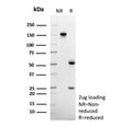 SDS-PAGE Analysis of Purified, BSA-Free Anti-CD14 Antibody (clone LPSR/553). Confirmation of Integrity and Purity of the Antibody.