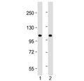 Western blot testing of human 1) lung and 2) HeLa lysate with NAT10 antibody at 1:2000. Predicted molecular weight ~116 kDa.