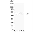 Western blot testing of Caspase-8 antibody and mouse samples: 1. Spleen, 2. Thymus, 3. Kidney, 4. Lung, 5. HEPA1-6 cell lysate. Predicted molecular weight: ~55 kDa (pro), ~40 kDa (large + small subunit), ~11 kDa (small subunit).