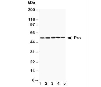 Western blot testing of Caspase-8 antibody and mouse samples: 1. Spleen, 2. Thymus, 3. Kidney, 4. Lung, 5. HEPA1-6 cell lysate. Predicted molecular weight: ~55 kDa (pro), ~40 kDa (large + small subunit), ~11 kDa (small subunit).