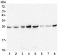 Western blot testing of 1) human HeLa, 2) human T-47D, 3) rat brain, 4) rat lung, 5) rat stomach, 6) mouse lung, 7) mouse stomach and 8) mouse kidney lysate with GSTM1 antibody at 0.5ug/ml. Predicted molecular weight ~26 kDa.