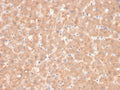 IHC staining of FFPE human liver with Factor VII antibody. HIER: boil tissue sections in pH 9 10mM Tris with 1mM EDTA for 20 min and allow to cool before testing.