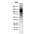 Western blot testing of human brain tissue with CD56 antibody (clone 56C04/123A8). Predicted molecular weight: ~110 kDa (soluble fragment), ~120/125 kDa (GPI-anchored), 140/180 kDa (transmembrane isoforms).