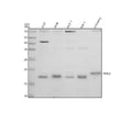 Western blot analysis of NME3 using anti-NME3 antibody. Electrophoresis was performed on a 12% SDS-PAGE gel at 80V (Stacking gel) / 120V (Resolving gel) for 2 hours. Lane 1: human 293T whole cell lysates, Lane 2: human SIHA whole cell lysates, Lane 3: human MCF-7 whole cell lysates, Lane 4: human THP-1 whole cell lysates, Lane 5: rat kidney tissue lysates. After electrophoresis, proteins were transferred to a nitrocellulose membrane at 150 mA for 50-90 min.