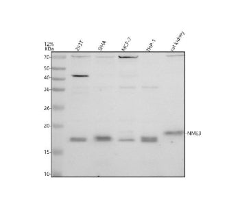 Western blot analysis of NME3 using anti-NME3 antibody. Electrophoresis was performed on a 12% SDS-PAGE gel at 80V (Stacking gel) / 120V (Resolving gel) for 2 hours. Lane 1: human 293T whole cell lysates, Lane 2: human SIHA whole cell lysates, Lane 3: human MCF-7 whole cell lysates, Lane 4: human THP-1 whole cell lysates, Lane 5: rat kidney tissue lysates. After electrophoresis, proteins were transferred to a nitrocellulose membrane at 150 mA for 50-90 min.