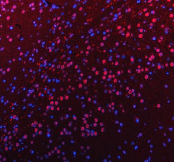 Immunofluorescent staining of FFPE mouse brain tissue with PUS7L antibody (red) and DAPI nuclear stain (blue). HIER: steam section in pH8 EDTA buffer for 20 min.